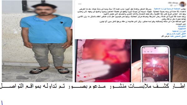 الداخلية تكشف ملابسات التعدي على شاب بآلة حادة وإصابته بالدقهلية