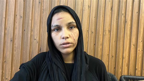 الدود بقى ياكل جسمي من الجروح