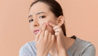 للحصول على بشرة نضرة.. احذروا هذه الأطعمة تزيد من ظهور الحبوب في الوجه