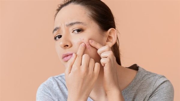 للحصول على بشرة نضرة.. احذروا هذه الأطعمة تزيد من ظهور الحبوب في الوجه