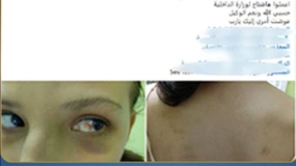 الداخلية تكشف ملابسات الاعتداء على طفلة في الدقهلية.. والنيابة تقرر تسليمها لخالة والدتها