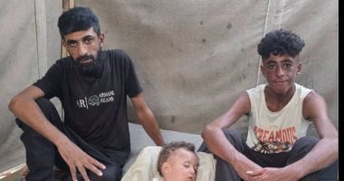 فقد عينه وشاهد ثلاثة من أصدقائه يرحلون أمامه.. أيمن أبو حليمة يعمل بعين واحدة لتأمين دواء ابنه.. أحد أطفاله أُصيب بحروق من الدرجة الثالثة.. بينما يكافح طفله الآخر مرضًا جلديًا يحرمه من النوم واللعب