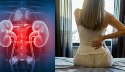 مش هتصدق.. هذه العادات في عطلة نهاية الأسبوع تضر الكلى