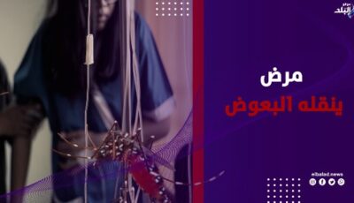تكسير العظام.. مرض فيروسي يثير القلق بعد ظهوره محليًا بأمريكا