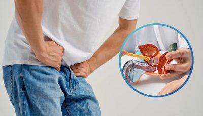 تضخم البروستاتا لا يرتبط بالتقدم في العمر ويبدأ مبكرًا