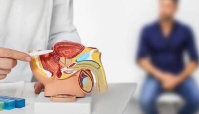 استشاري مسالك يكشف أحدث طرق علاج تضخم البروستاتا