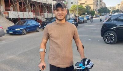 فقد ساقه ولم يفقد الأمل.. شاب من غزة يكافح من أجل لقمة العيش بشوارع القاهرة